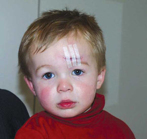 خطر بریدگی در کودکان را جدی بگیرید